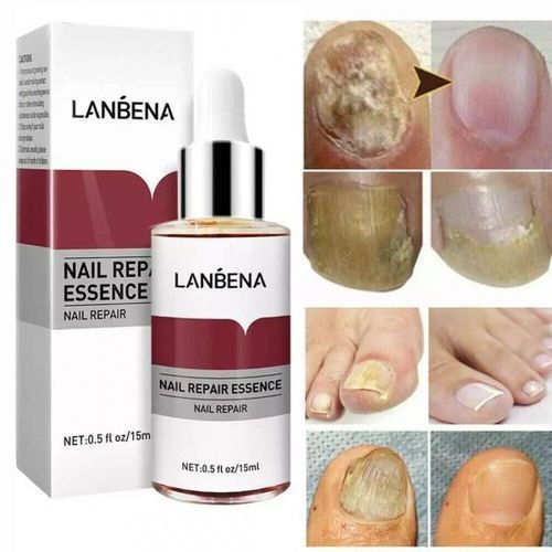 Lanbena Nail Repair Oil